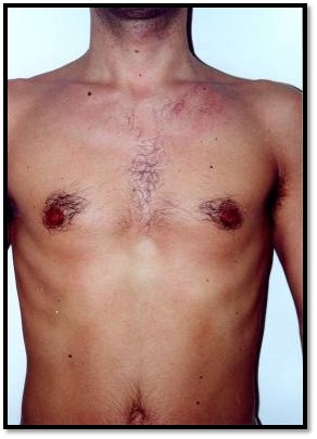 Male_HR_B&A_1